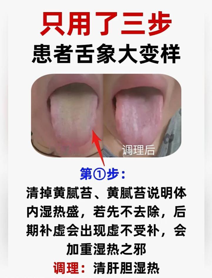 湿热体质切勿盲目进补，三步调理，看舌象的前后变化
