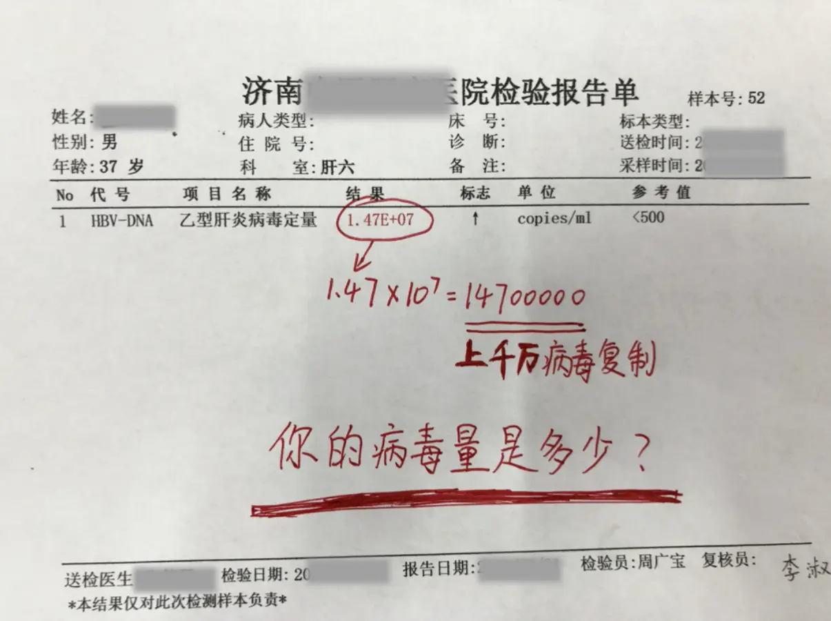 37岁的乙肝大三阳，病毒量7次方，体内每毫升血液中有上千万的病毒在复制...