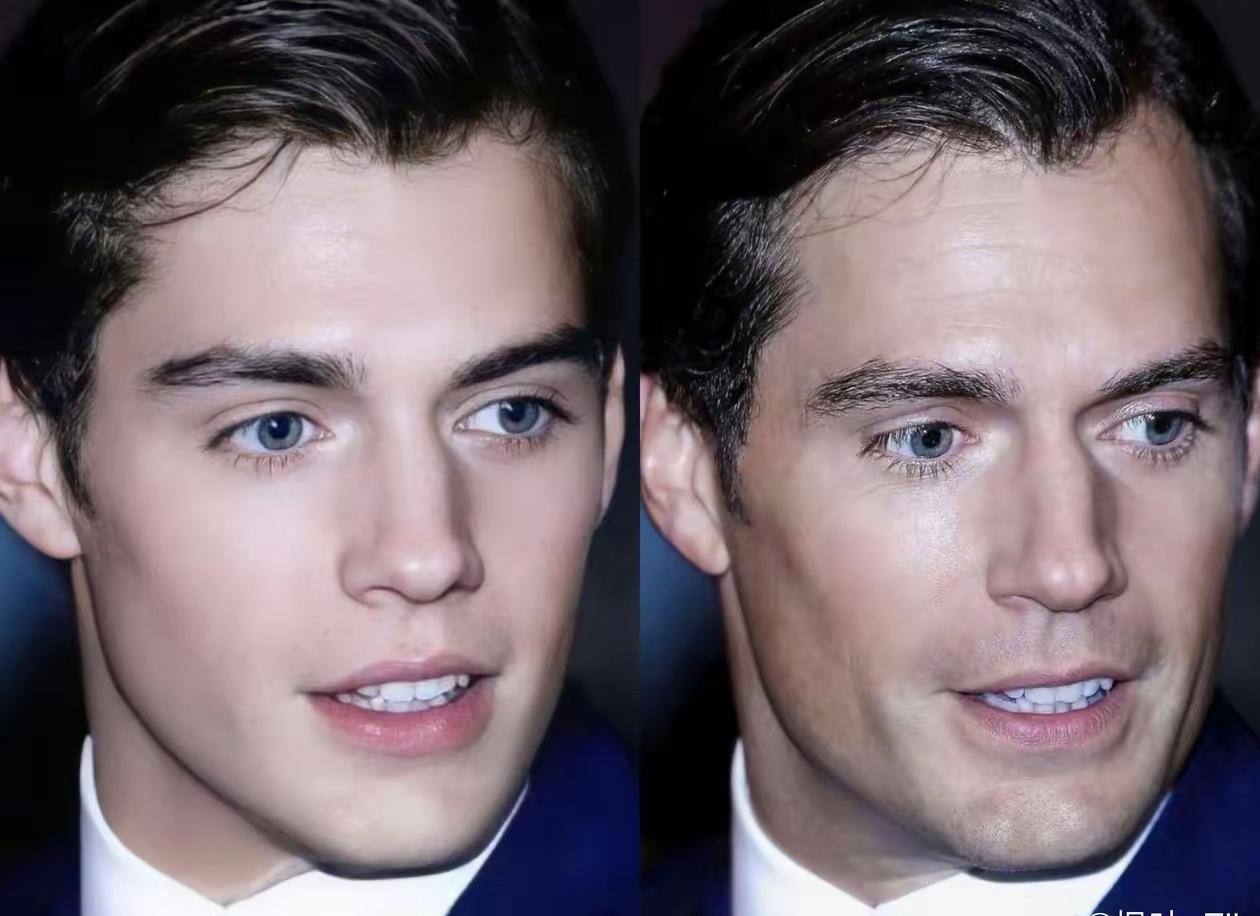 我觉得还是右边的脸比较好看，这是同一个人的两张照片，右边的自然原始天然，左边的是