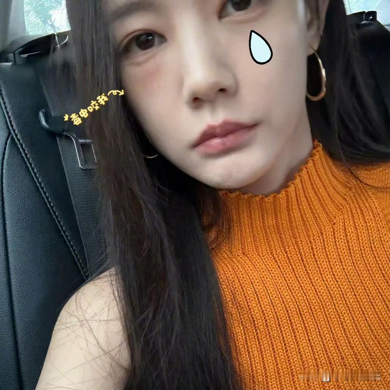 李一桐近日在社交平台分享了自己户外出行的小插曲，素颜出镜的她脸颊带着一处明显的红