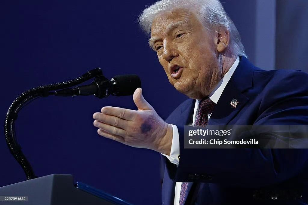 眼尖的媒体记者在达沃斯论坛上发现特朗普左手手背上有明显的大片瘀青，对此特朗普回应