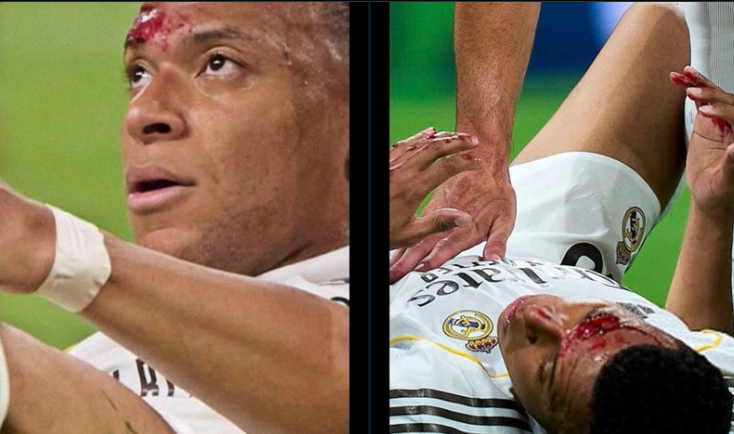 该判点球吗？姆巴佩遭肘击满头是血，主裁未判罚引发争议 