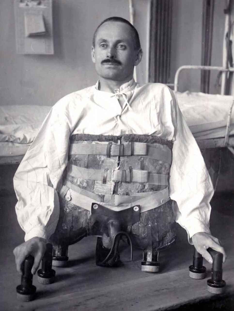 【来自投稿】多米尼克·穆勒是一名德国士兵，1917年4月15日 在战斗中他被炸掉