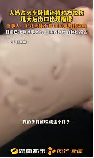 卧铺座位被占反被咬伤，伤口长出疱疹，蛮横占便宜的代价该谁买单
 
“太吓人了！”