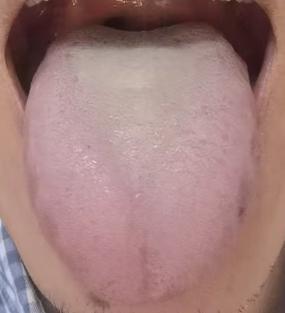 一味实用小方，培补身心本源，中年底气十足，年长也能稳住状态






有患者常