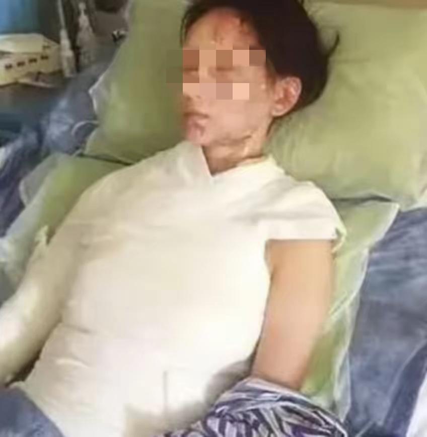 “这就是嘴欠的下场！”浙江，只因5分钟等汤、几句恶语辱骂，28岁女子被一盆滚烫开