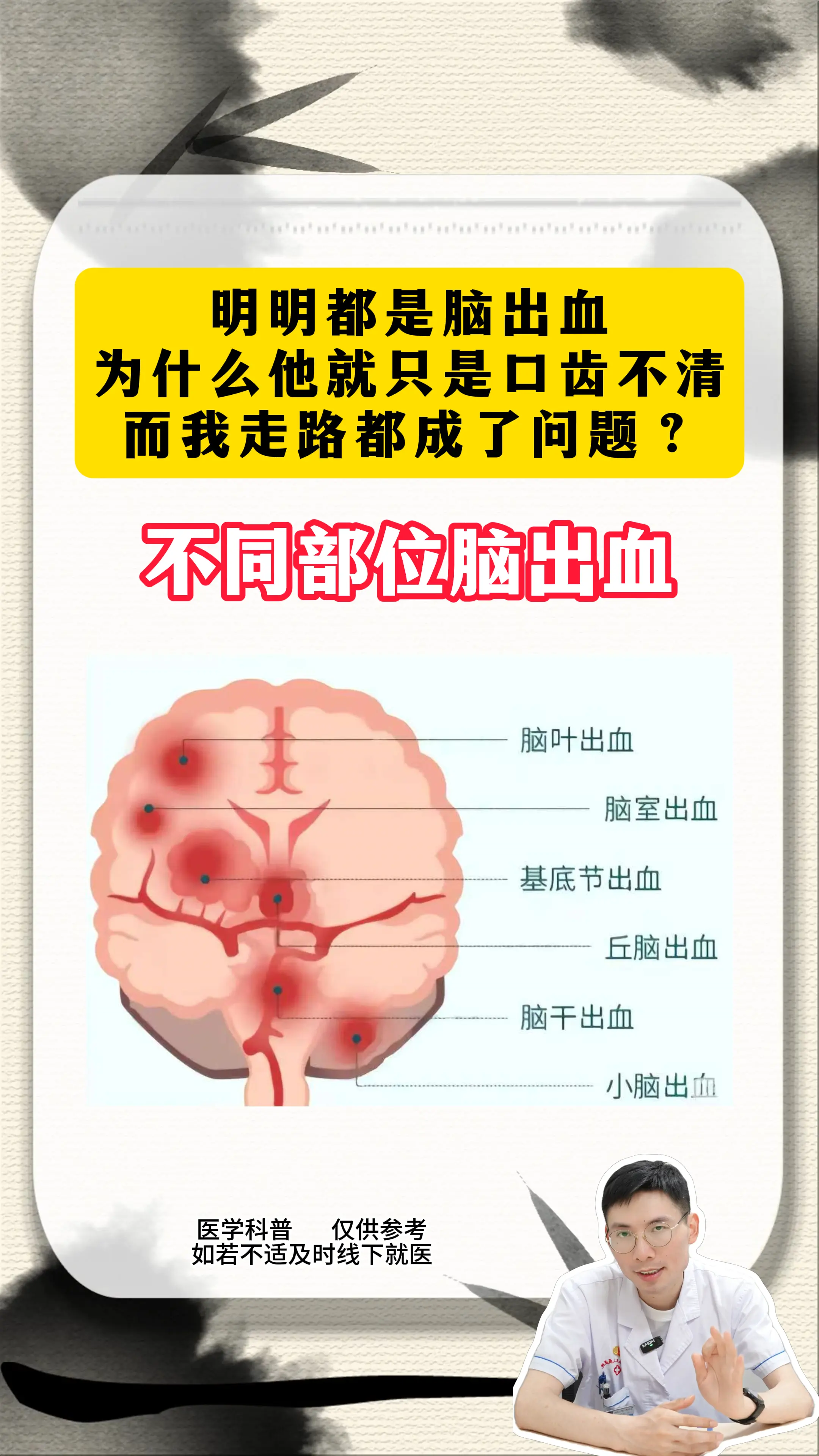 基底节区：脑出血好发部位约占总数的70% 最常见的症状为偏瘫 基本无法...