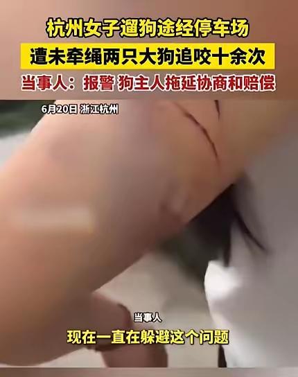 太吓人了！杭州女子遛狗遭两条大狗疯狂撕咬，狗主拒赔，受害者只能独自疗伤
 
太吓