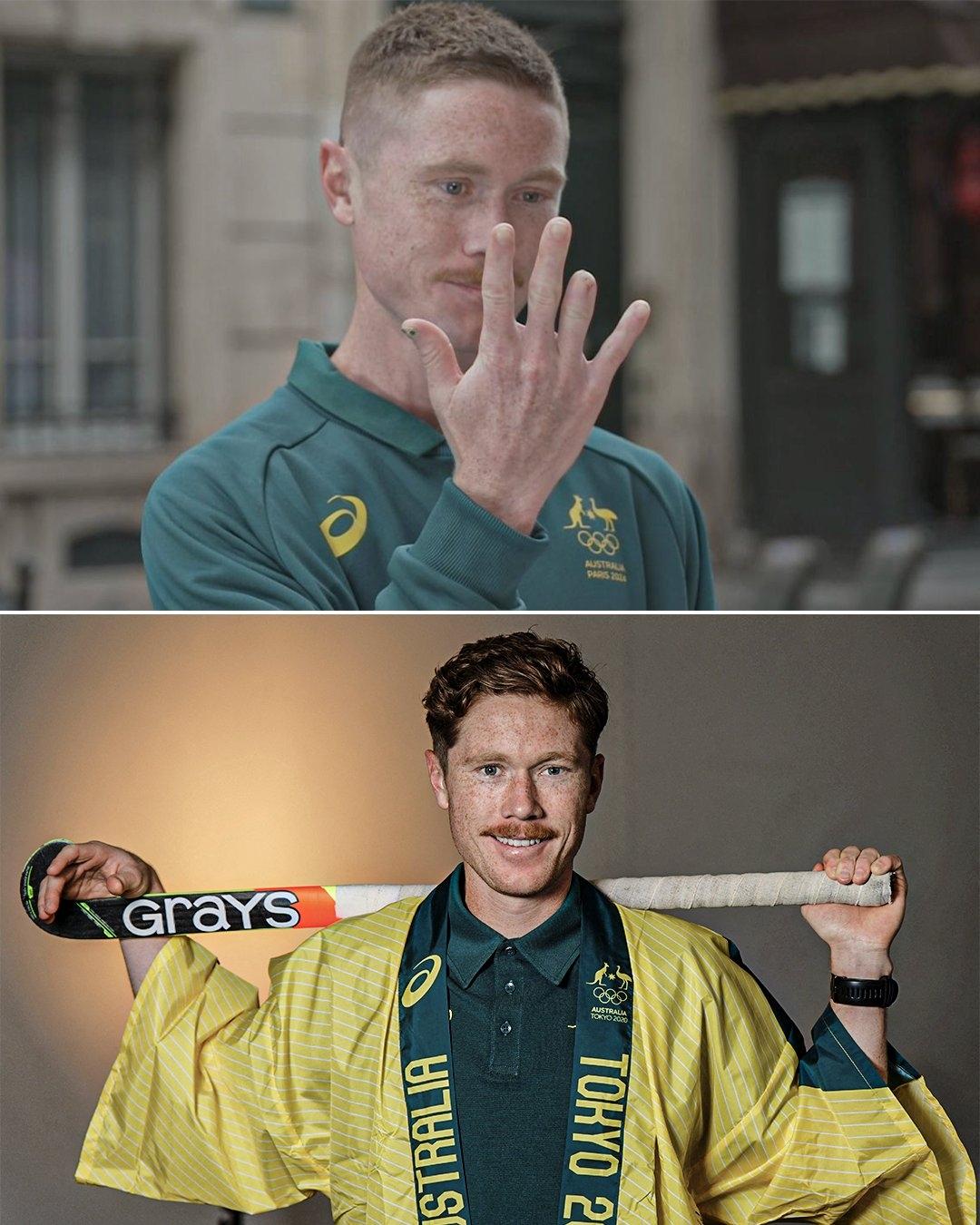 太狠了！澳大利亚选手赛前手指严重受伤，但为参加奥运选择截肢

据ESPN等多家媒