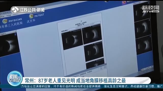 江苏新闻 常州87岁老人重见光明 成当地角膜移植高龄之最