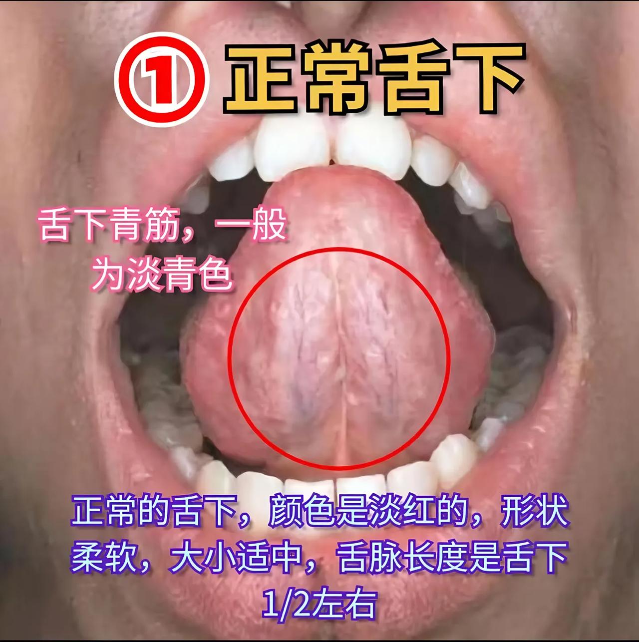 身体是否有淤血，中医教你30秒自测！[中国赞][中国赞][中国赞]
粉丝朋友们，