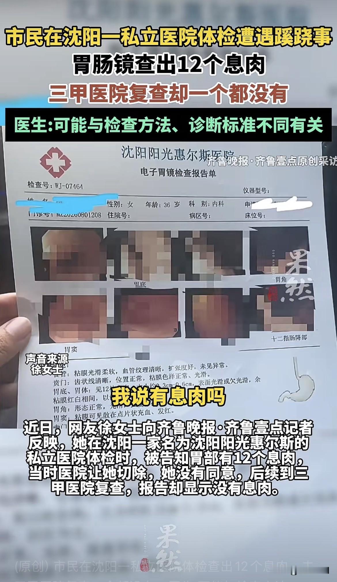 沈阳，妻子陪丈夫到私立医院体检。丈夫先做无痛胃镜，查出4个息肉，妻子做完检查医生