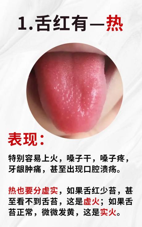 舌头的 4 种形状，藏着你身体的秘密