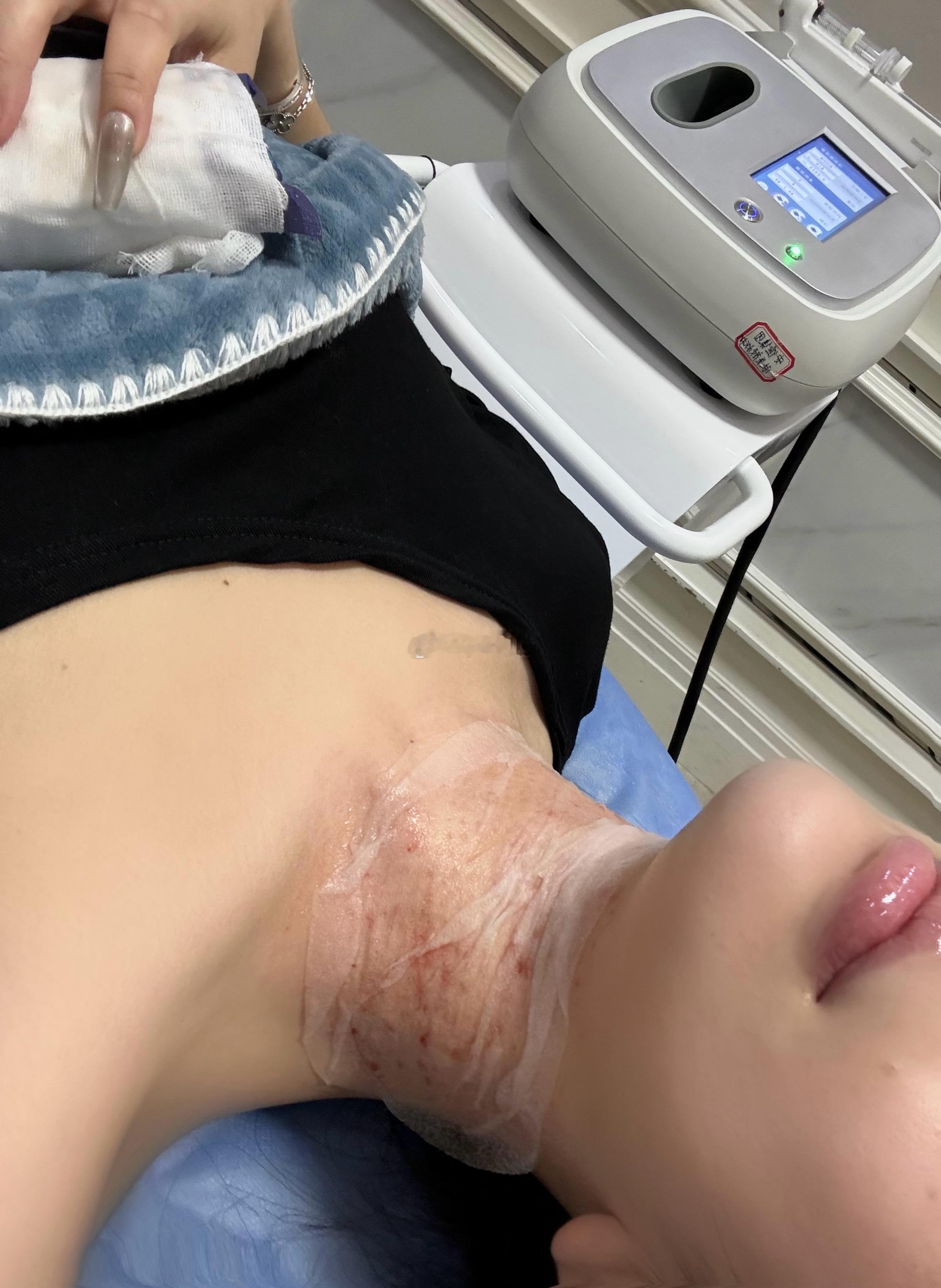 赚点逼钱全炫身上了 ​​​