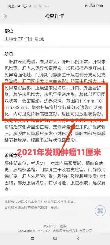 你看过有几个胰腺癌活过1年的?胰腺癌生存期超过一年的还是很多的，我们治疗的患者，