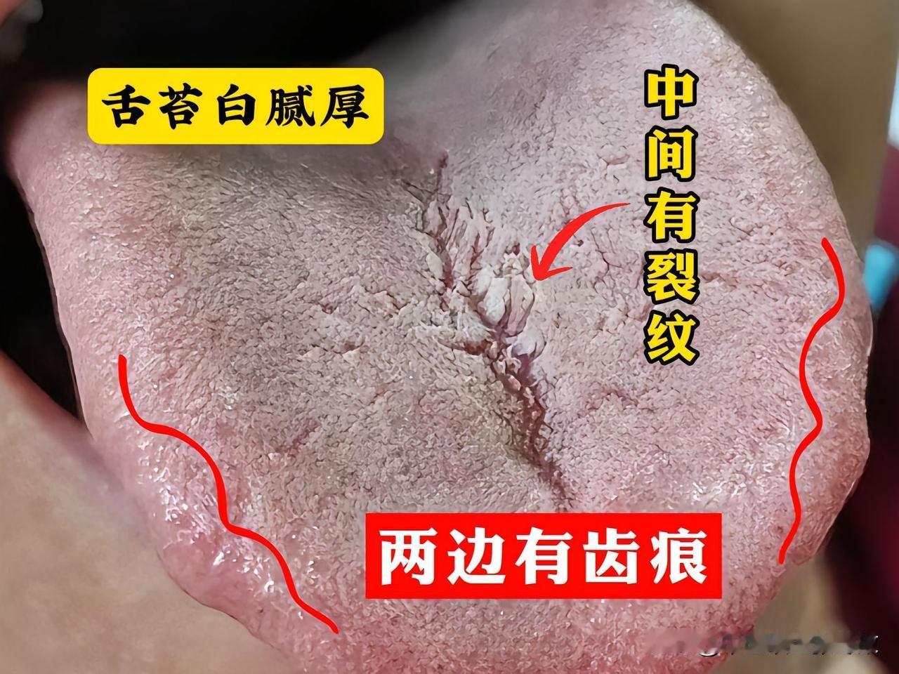 门诊大哥，才31岁，但男科惨的真是一塌糊涂[捂脸][捂脸][捂脸]
3分钟都坚持