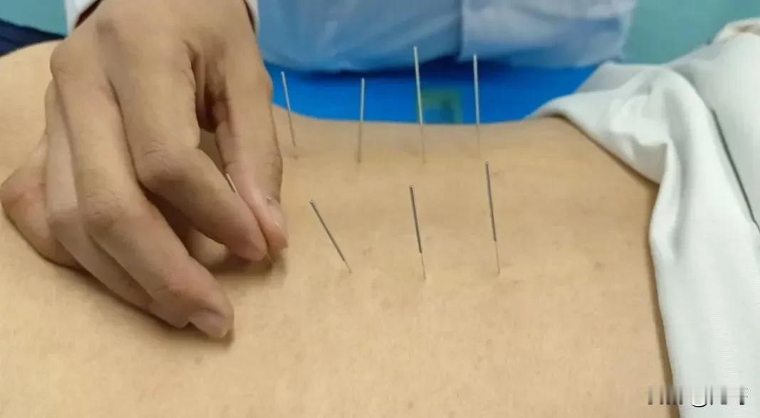腰间盘突出中医可以治好吗?腰椎间盘突出在中医理论中属于“腰痛”“痹证”等范畴，中