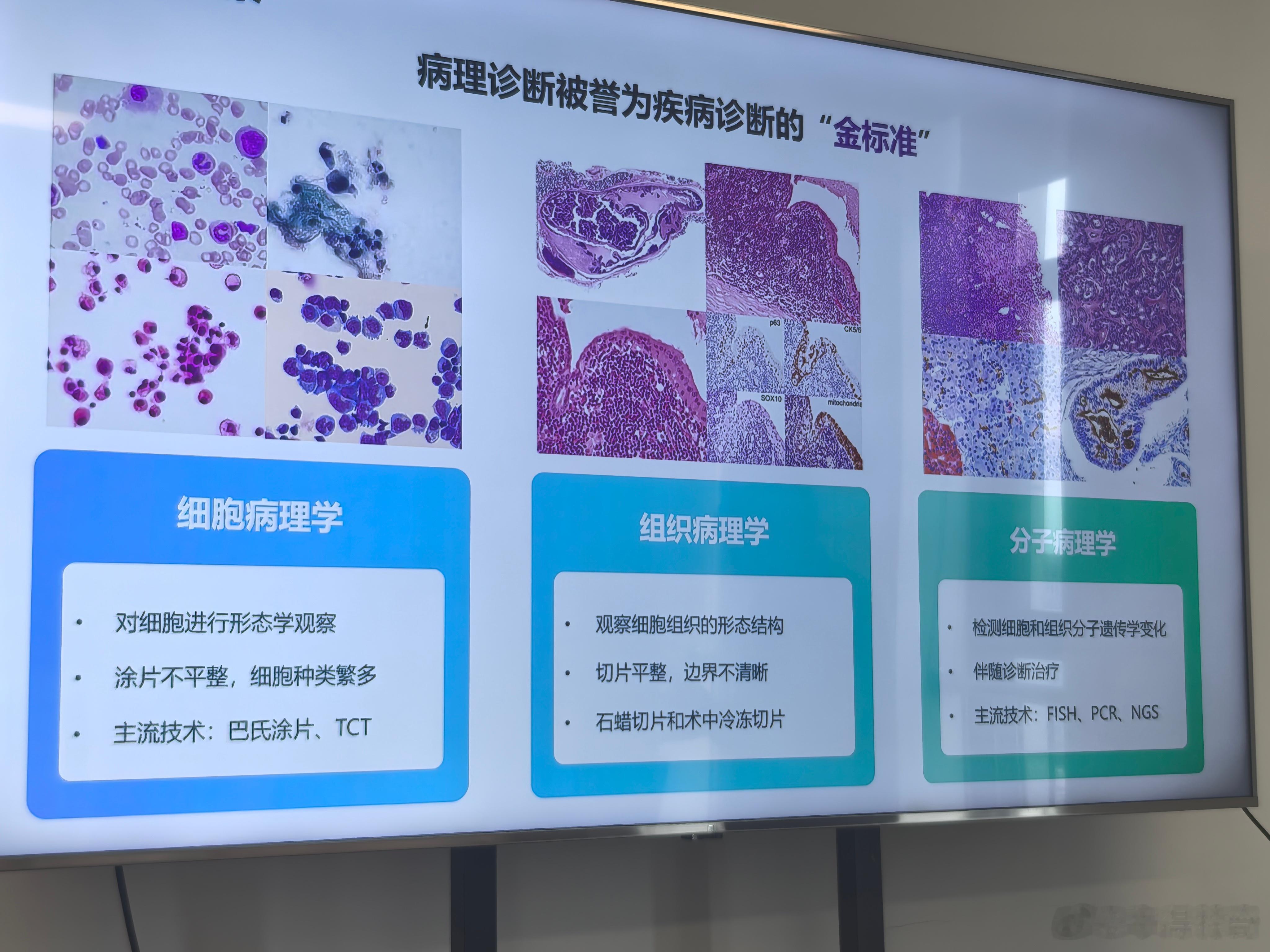 AI技术已将细胞筛查缩短到每张涂片10分钟，尿液中癌症脱落细胞的检测成本降到10