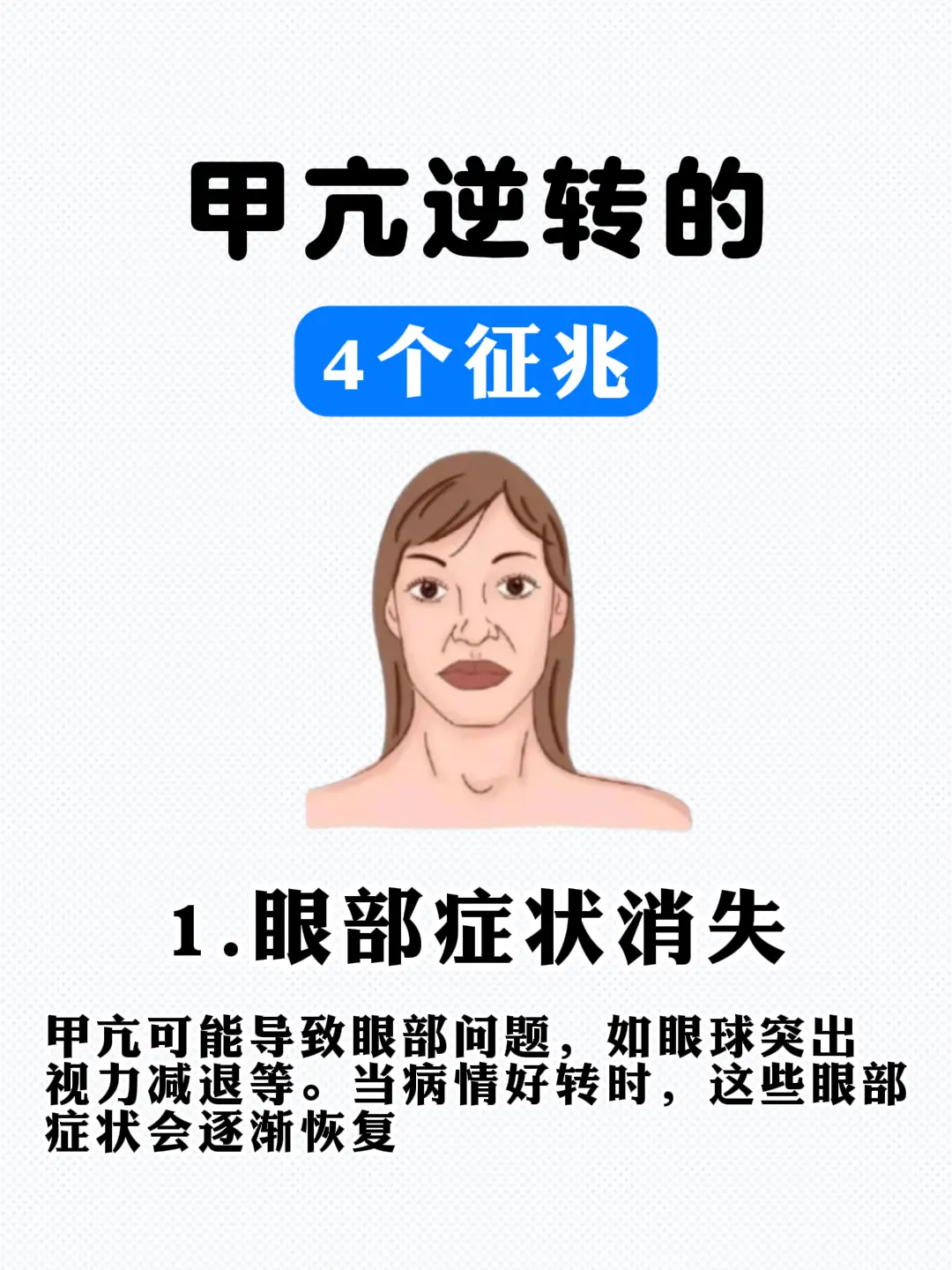 甲亢 健康科普