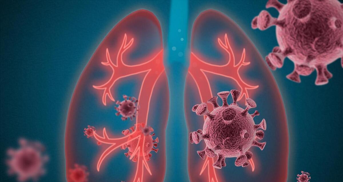 新冠严重程度和感染人数呈正相关，这一次重症患者不会超过上一次
新冠患者近日来逐渐