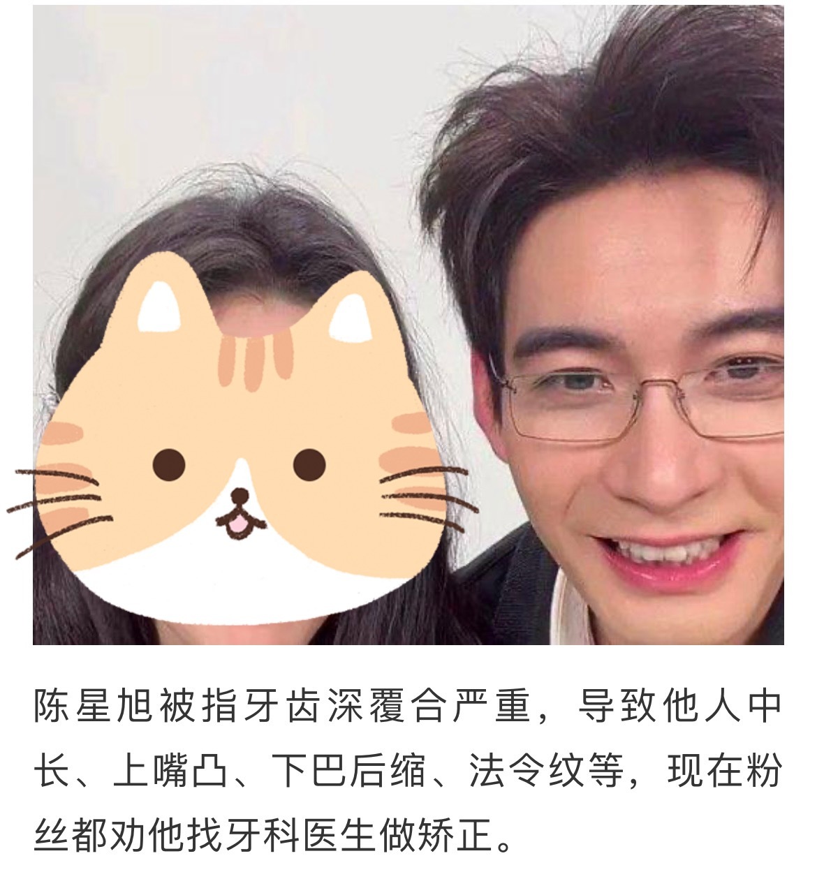 希望嘴部发育过度有牙齿深覆合问题的男演员可以自觉退出现偶或者主动拒拍吻戏[揣手]