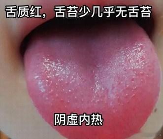 阴虚火旺，到底是哪里阴虚了？阴虚火旺；一般是指，肝阴虚，肾阴虚，肺阴虚；一说阴虚