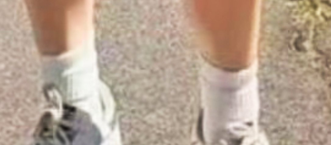 小腿