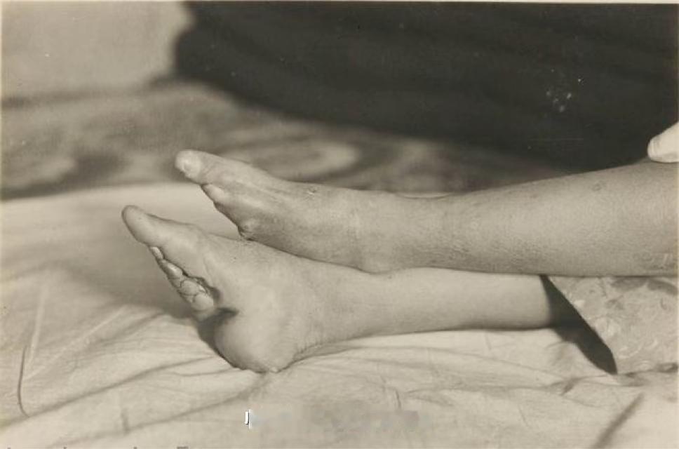 看到“中国女性的四寸银莲”，就想到与之相关的三寸金莲。三寸金莲最早可追溯到宋代，