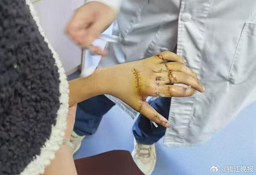 #双胞胎姐妹遭袭1死1伤爸爸最新发声#【双胞胎姐妹遭妹妹男友伤害致1死1伤案，即