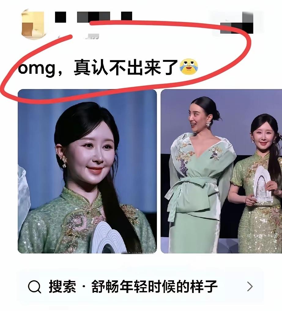别让过度医美毁了你的后半生颜容
和充气娃娃没两样