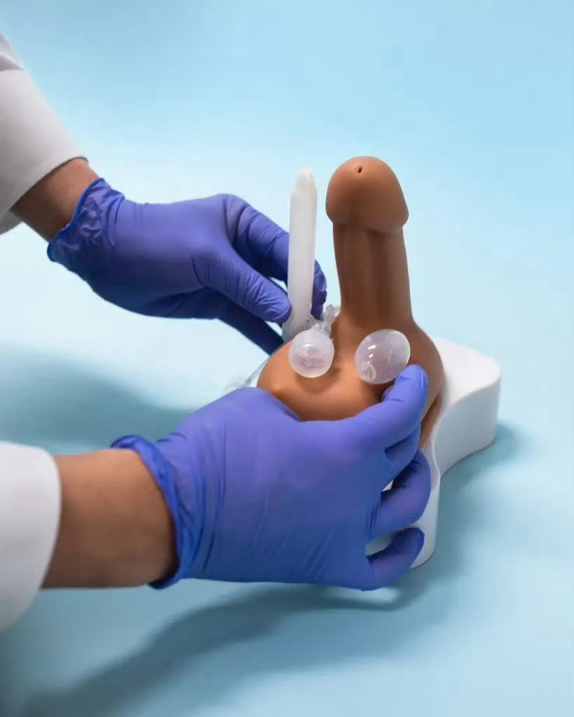 63岁男子植入阴茎假体获老伴支持¹ 女变男的变性手术也会用到。在美国做这个手术贵