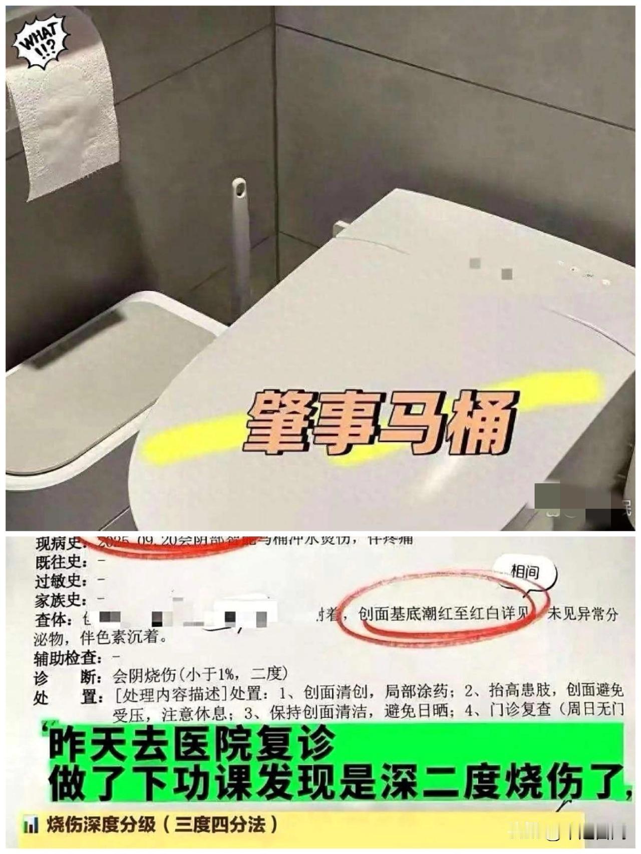 我很想能够帮上她，但我没看到烫伤部位的情况，也不好随意乱说。
女子上厕所被烫到直