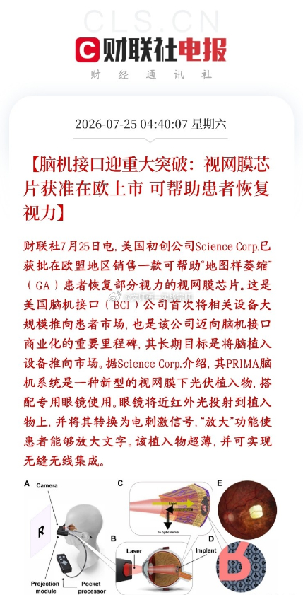 海外脑机接口实现首次商用，A股概念板块下周迎反弹催化周末脑机接口领域迎来关键突破