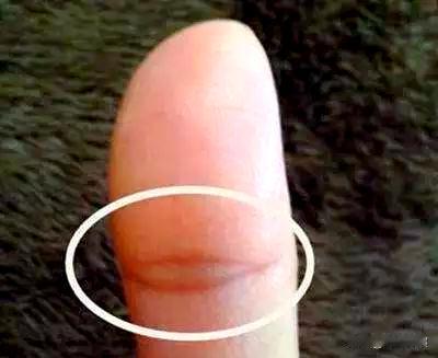 大拇指有“佛眼”的人不简单：手有佛眼，自带佛光，不慌不忙，自有福报
“佛眼”也叫