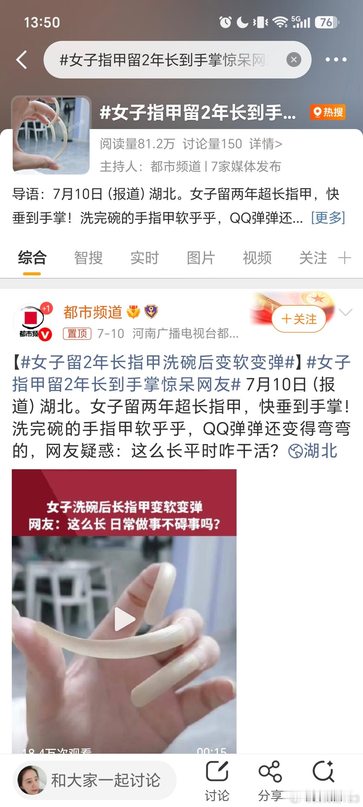 无意中刷到的，看着我都很难受我是受不了一点长指甲，稍微长一点就得剪就，但是不会特
