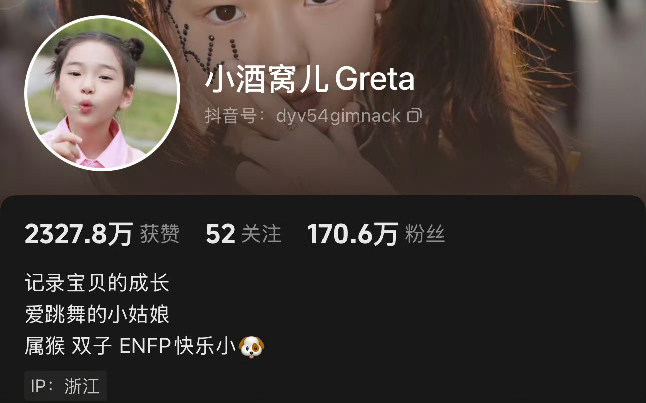 杜淳妻子说小酒窝是为镜头而生的小酒窝用实力印证！年纪小却hold住镜头，颜值与表