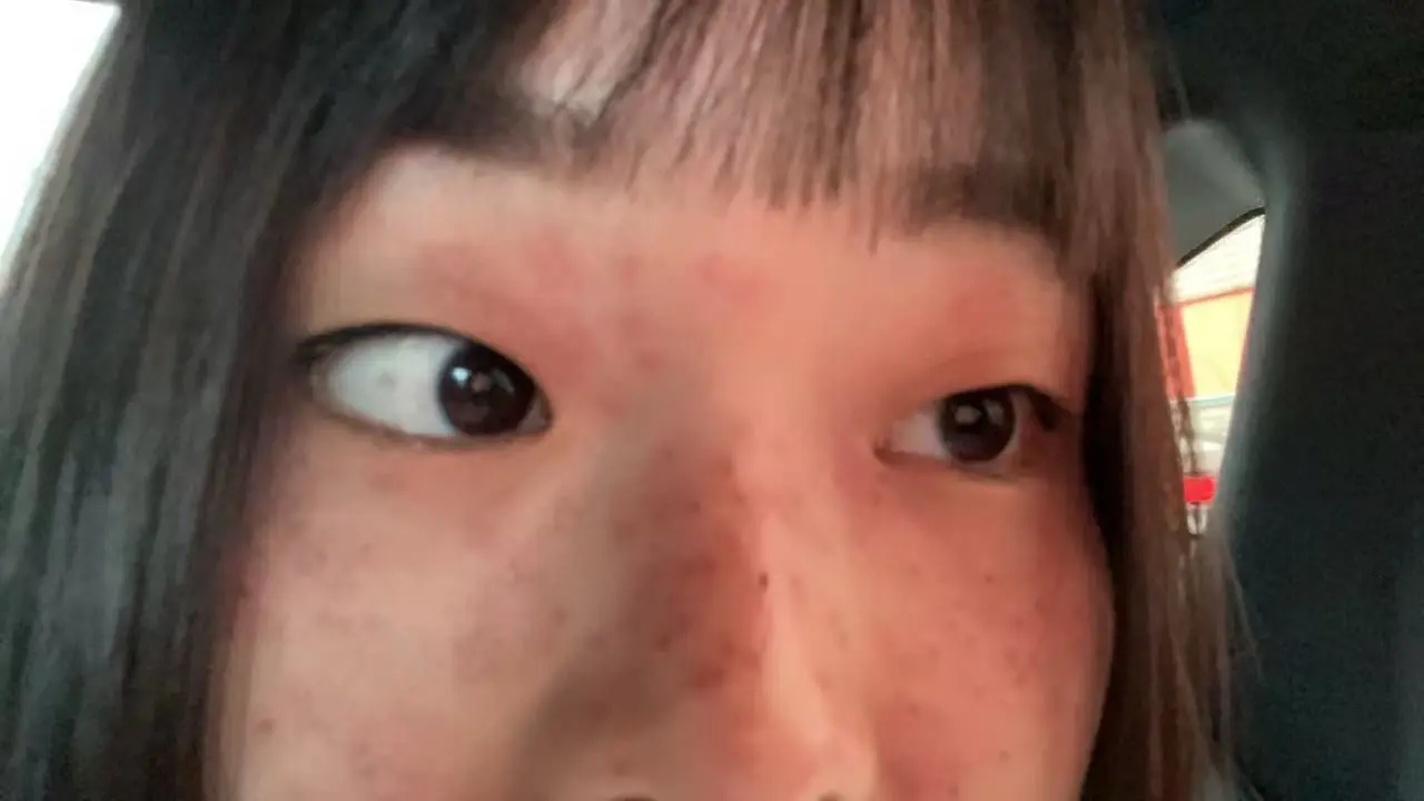 未来先生，我脸上排毒成功了记录脸部排毒