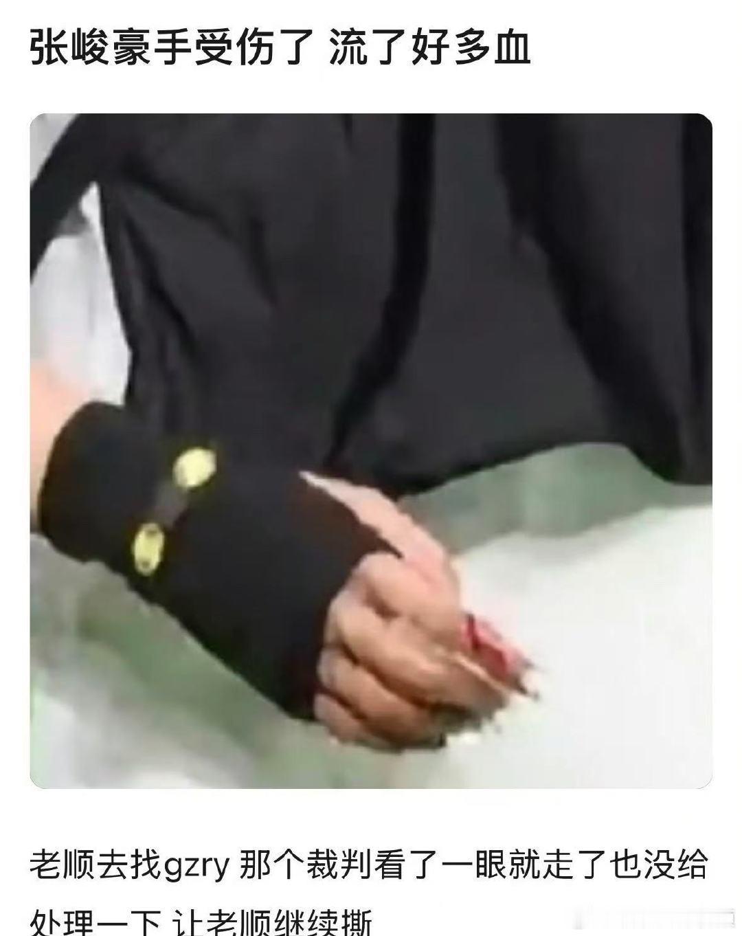 张峻豪手受伤了张峻豪手受伤流血了张峻豪手流血了张峻豪手伤流血