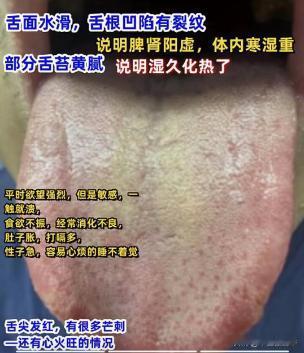 你留舌头，我来分析
1.脾肾阳虚，寒湿重
2.心肝火旺，湿热下注
3.痰瘀重，心