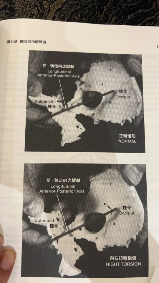 枕头与蝶骨竟然影响呼吸