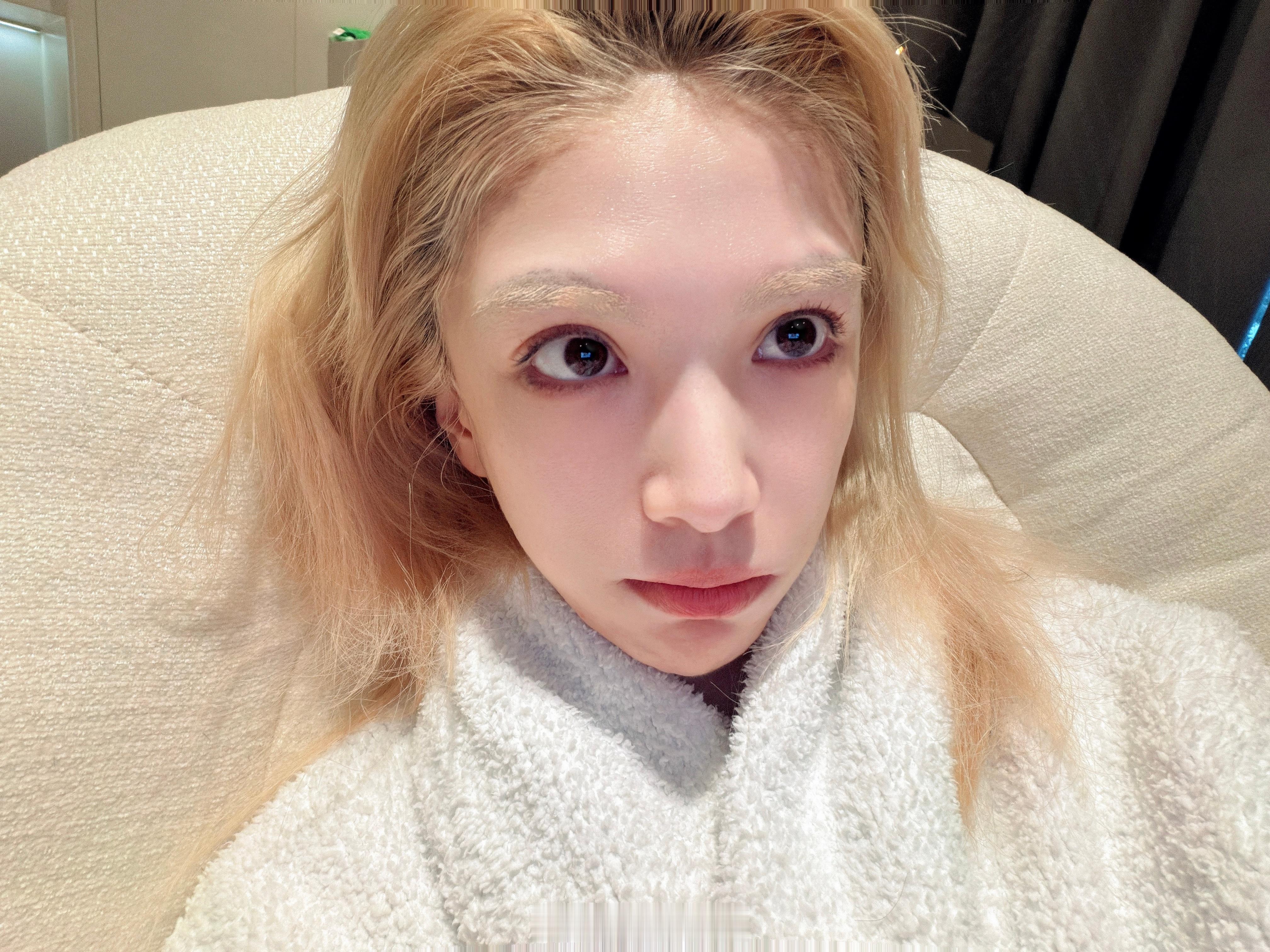 这回脸也没脂肪了 