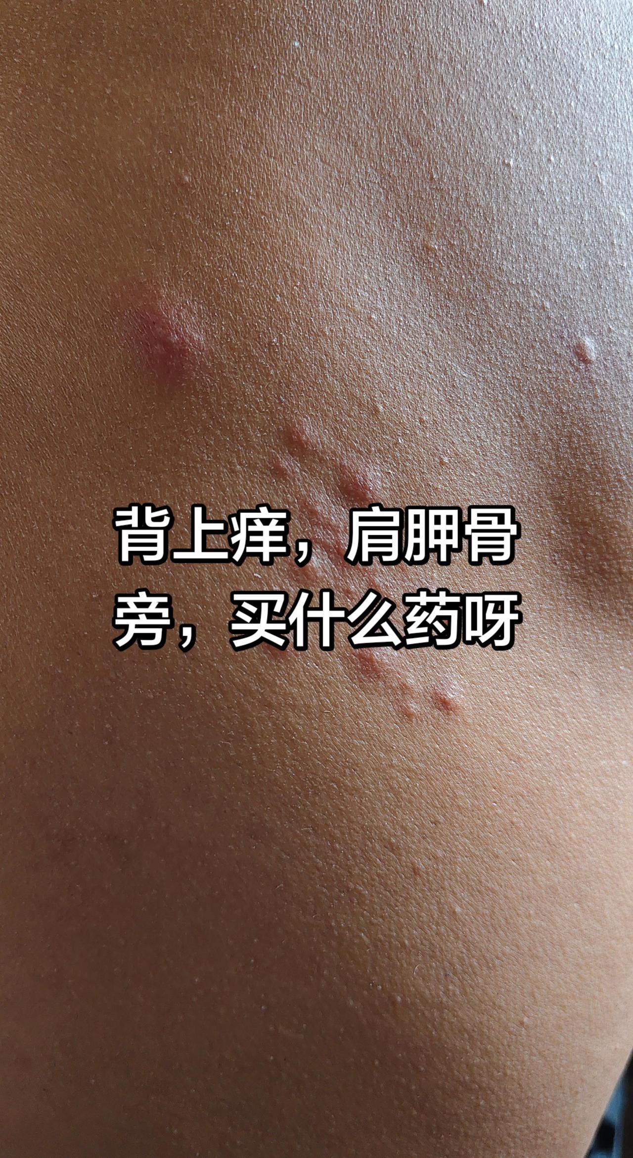 皮肤上的故事 皮外伤