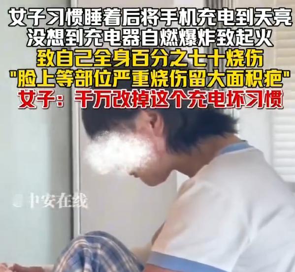 女子彻夜充电致全身70%烧伤 我猜测大概就是充电器问题，要不就是插板问题原装的很
