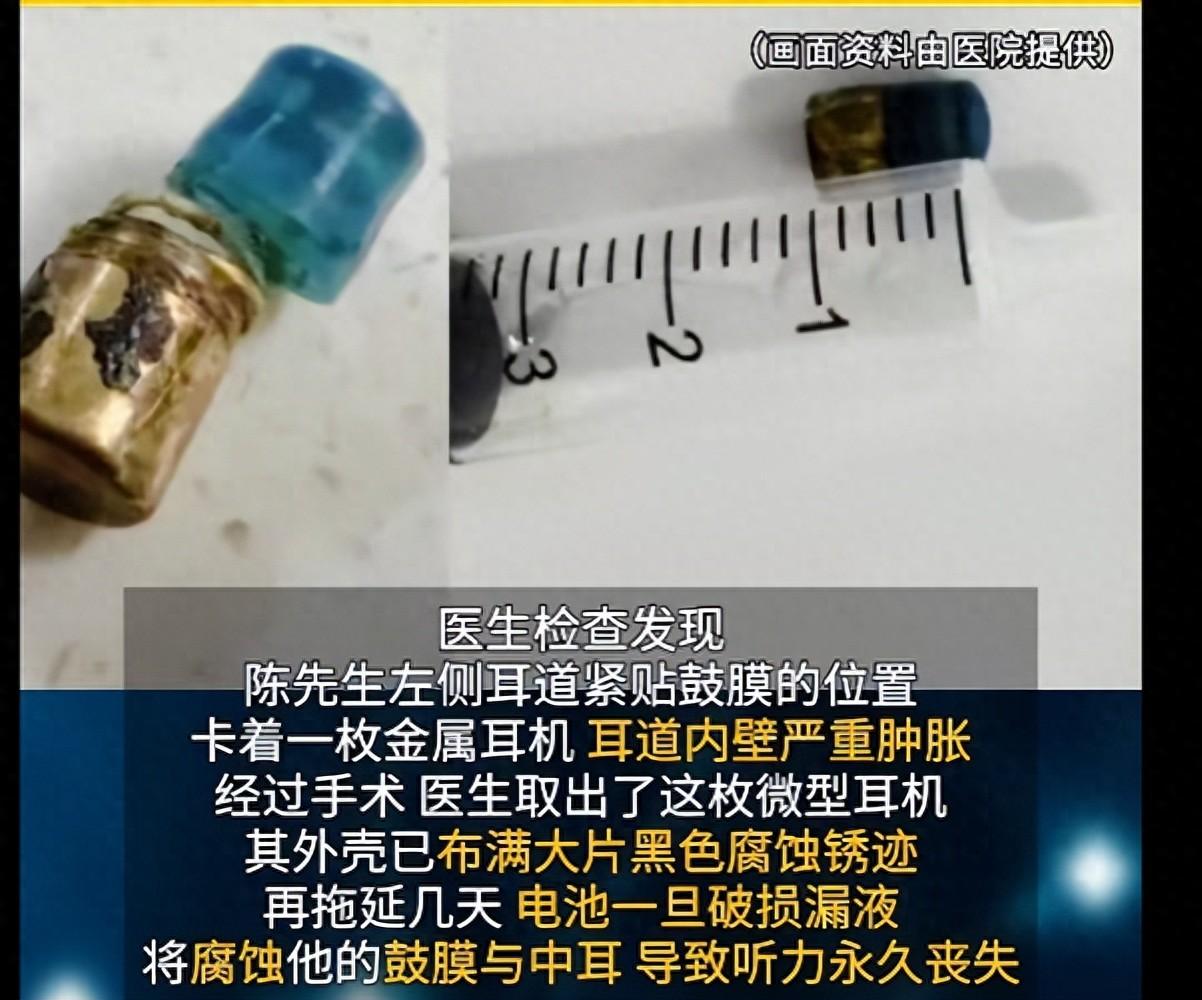 “悲剧还是发生了！”7月20日报道，浙江，一男子买了超微型蓝牙耳机，他佩戴时都用