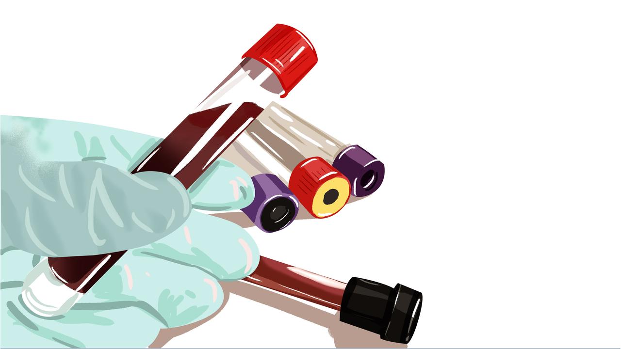 宝宝血常规化验单怎么看

正常参考值在化验单的右侧都有注明，查出来的结果除有数字