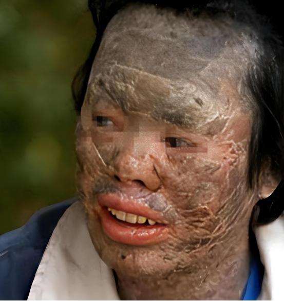 吃蛇太多变蛇人？2003年辽宁省，村民韩永波有个特殊的爱好——爱吃蛇，不仅顿顿有