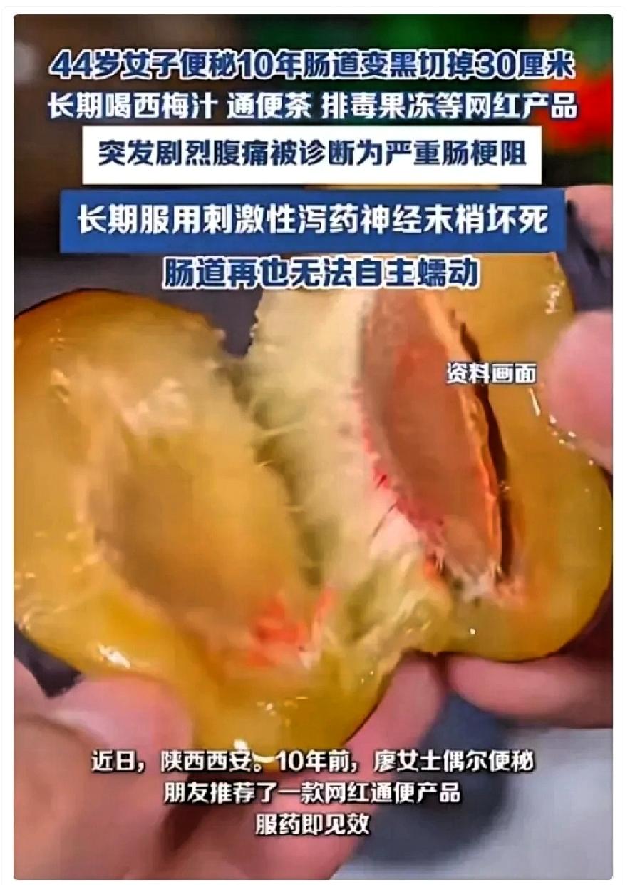 悲剧还是发生了！
陕西，一女子因为便秘，长期喝西梅汁、通便茶等饮品，一坚持就是1