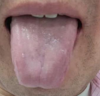 房事力不从心，补足阳气，疏通气机是关键






很多男同志因为各种各样的原因