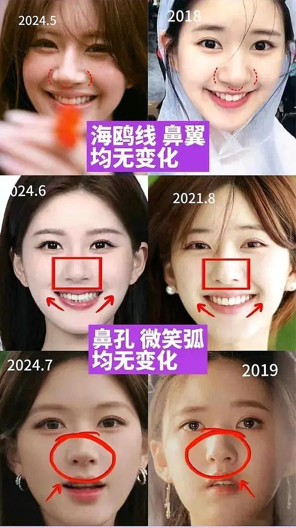 赵露思整容澄清贴🈶，这么看是不是也没什么差别？ ​​​