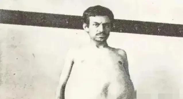 1940年，一位美国男子正在排泄大便时突然死亡，当法医检查过后发现男子体内竟然堆